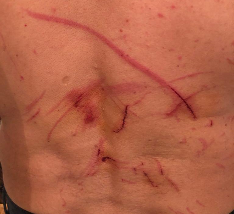 Vater schwer verletzt2