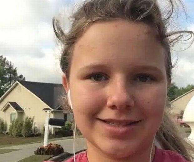 Mädchen von Pit Bulls skalpiert