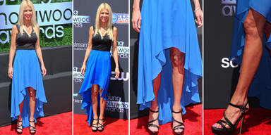 Diese Knie sind erst 37 Jahre alt