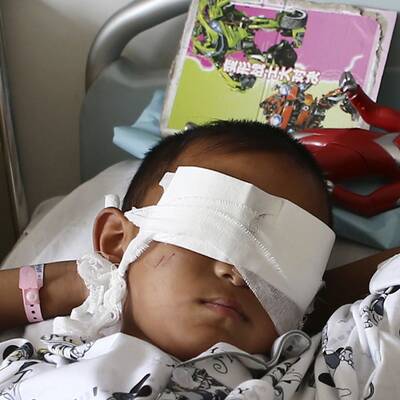 Drama in China: Die eigene Tante raubte Guo Bin das Augenlicht