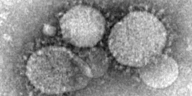 MERS-Kranke in Wien: Zustand kritisch