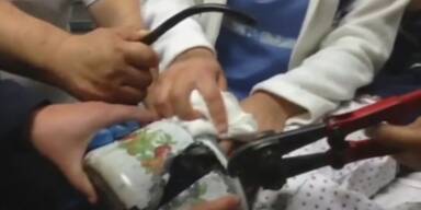 Kind aus Teekessel befreit