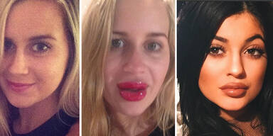 Kylie Jenner Lippen