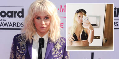 Kesha: Bikini zu klein