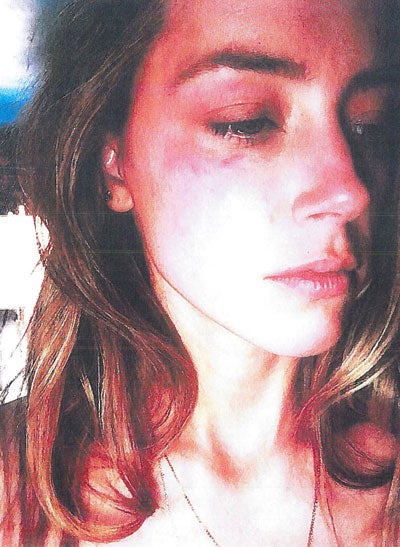 Hat Johnny Depp seine Ehefrau geschlagen?