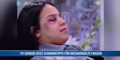 20161129_66_87043_161129_MO_111_Schminktipps-misshandelte-Frauen.jpg