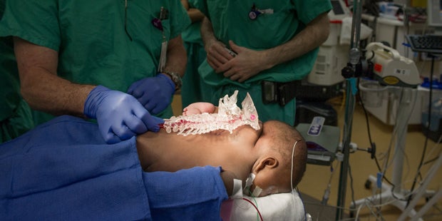 Kind mit vier Beinen und zwei Wirbelsäulen