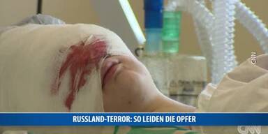 20170405_66_113145_170405_CNN_Russland_Terror_Krankenhaus.jpg