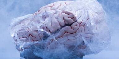 "Hirnfrost"