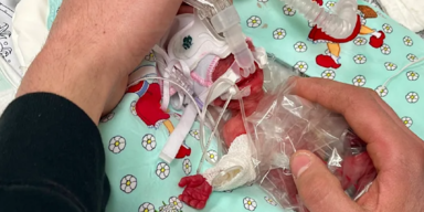 Baby-Wunder: Kleine Marie kam mit nur 265 Gramm zur Welt