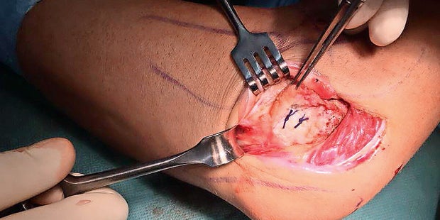 Jürgen Melzer schockt mit OP-Fotos