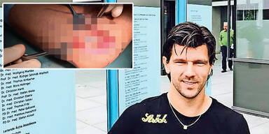 J&uuml;rgen Melzer schockt mit OP-Fotos