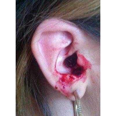 Dieses Mädchen weint Blut