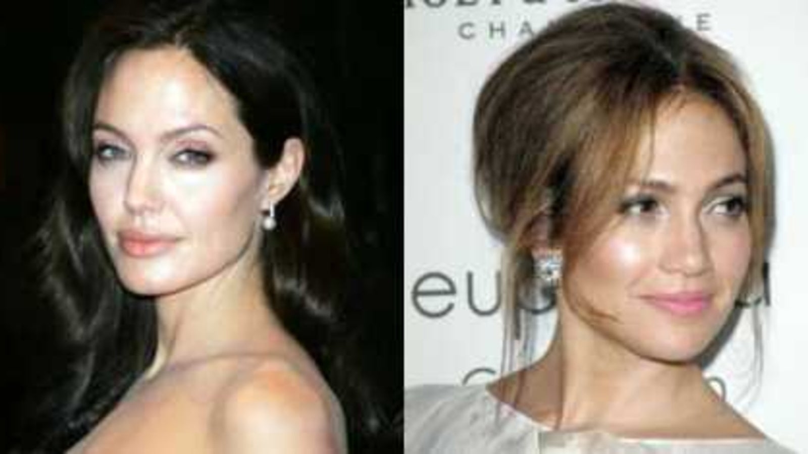 sch-nheits-ops-der-stars-madonna24-at