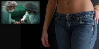 Sch&ouml;nheits-OPs im Intimbereich