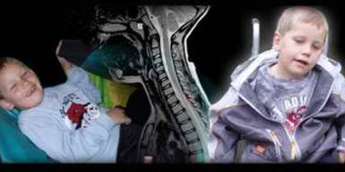 Querschnittsgel&auml;hmter Bub kann wieder gehen