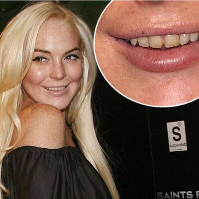 Lindsay und ihrer Beauty-Pannen 