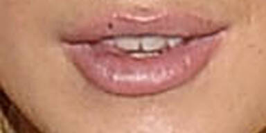 Neue Lippen für Lindsay Lohan