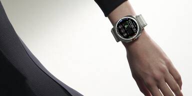 Doktor Smartwatch: Wie gut sind die Wearables wirklich?