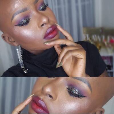 Brandopfer macht anderen Mut