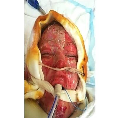 Drei Jahre später zeigte Dana ihr neues Ich