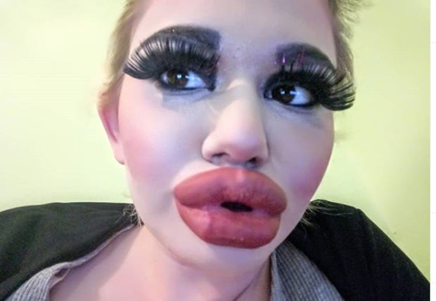 SIE hat die dicksten Lippen der Welt