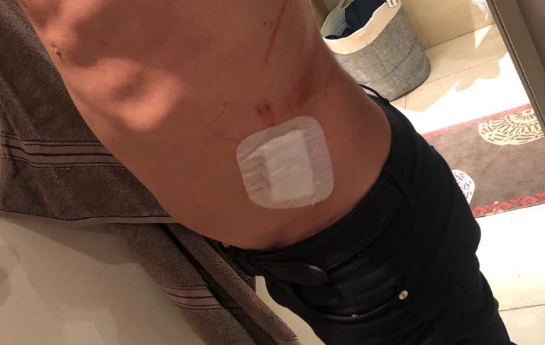 Vater schwer verletzt3