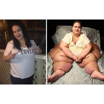 Beeindruckende Vorher-/Nacher-Bilder