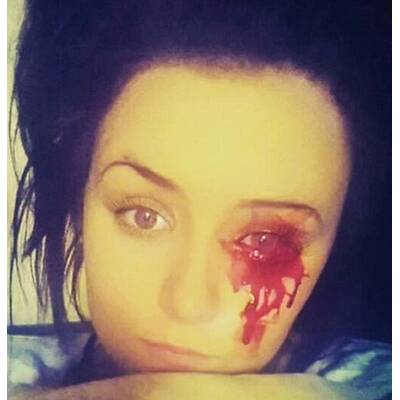 Dieses Mädchen weint Blut