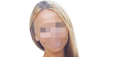 Hund zerbeißt Beauty das Gesicht