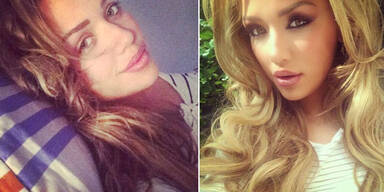 Kim Gloss: natürlich nach Beauty-OP-Gerücht?