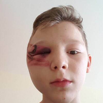 Rassismus-Attacke auf Brüder