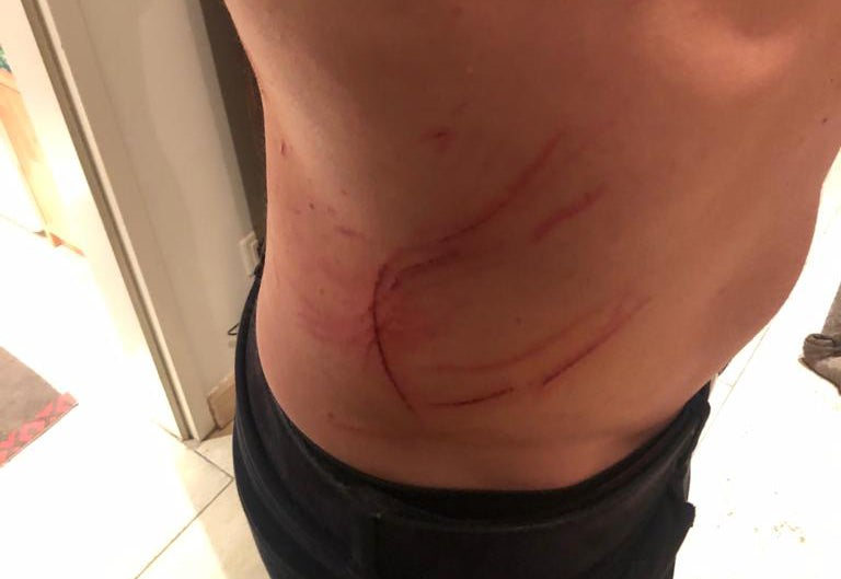 Vater schwer verletzt 4