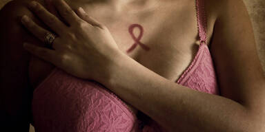 Brustkrebs