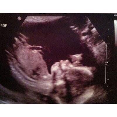 Babys im Bauch: Die witzigsten Bilder