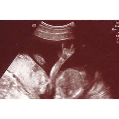 Babys im Bauch: Die witzigsten Bilder