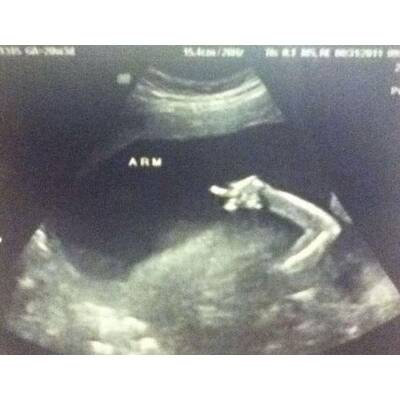 Babys im Bauch: Die witzigsten Bilder