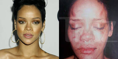 So schlimm wurde Rihanna verprügelt