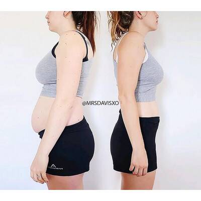 So verhilft das Workout zur Traumfigur