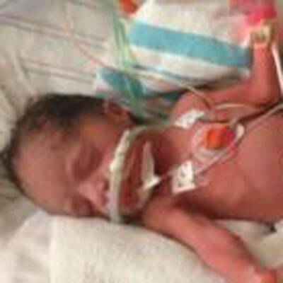 Die Vierlinge müssen medizinisch überwacht werden. 