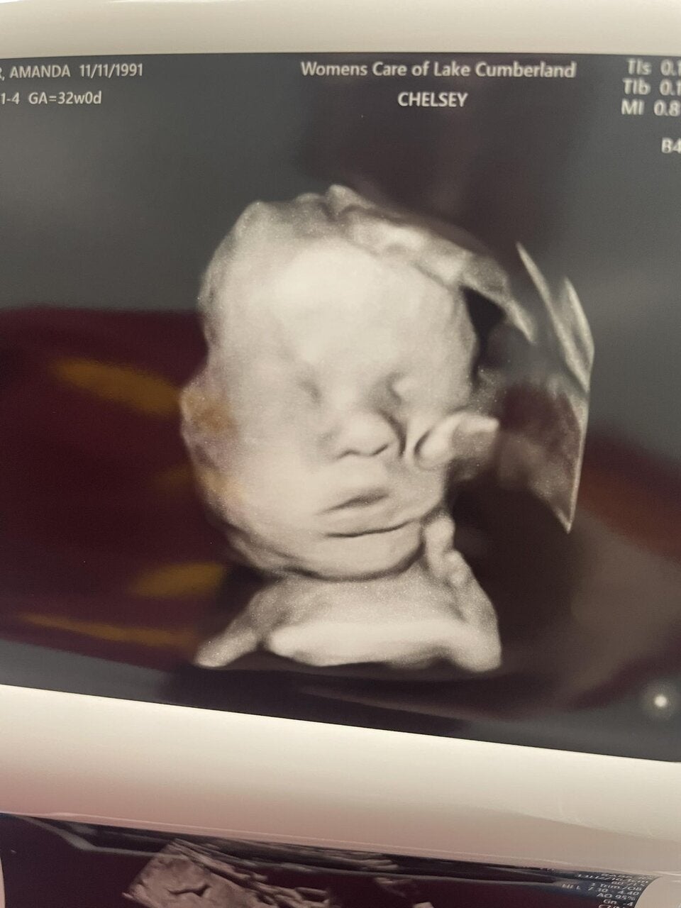 Ultraschallbild zeigt auffällige Hand – Amanda sieht darin ein Zeichen ihres Glaubens.