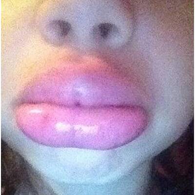 Farbige Kontaktlinsen