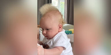 Baby kommt mit Irokesenfrisur auf die Welt