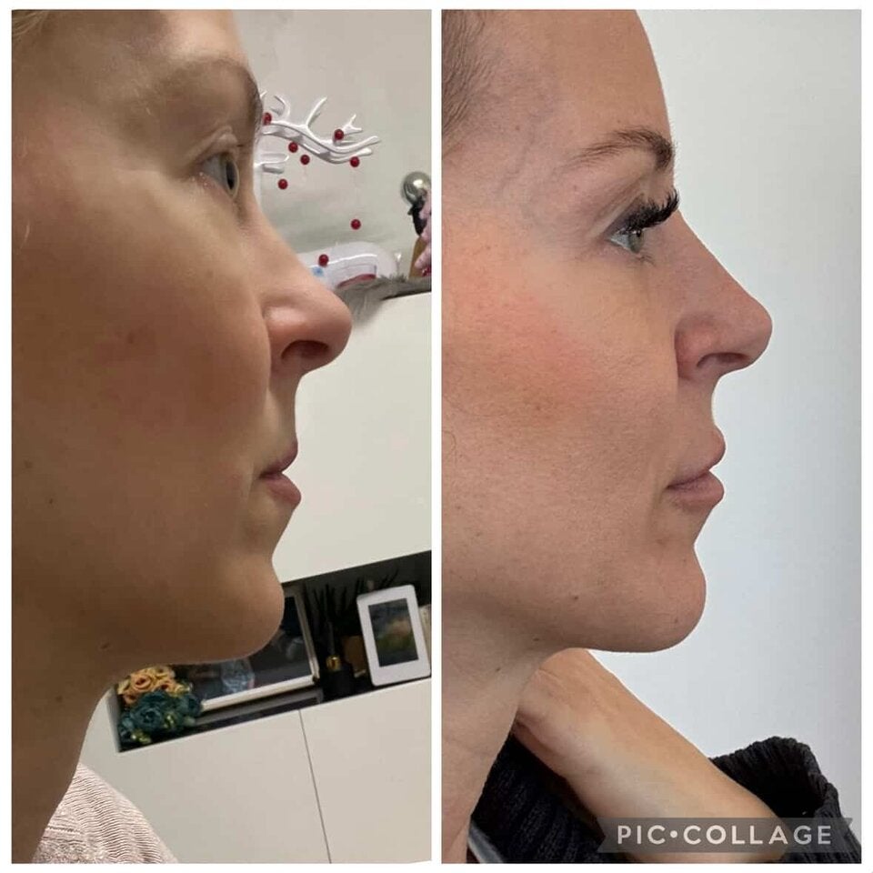 Der Vorher-Nachher-Vergleich