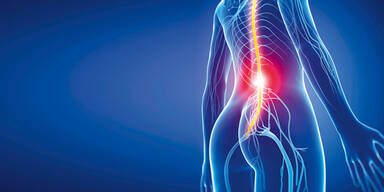 R&uuml;ckenschmerzen