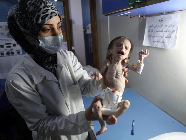 Die hungernden Babys von Syrien