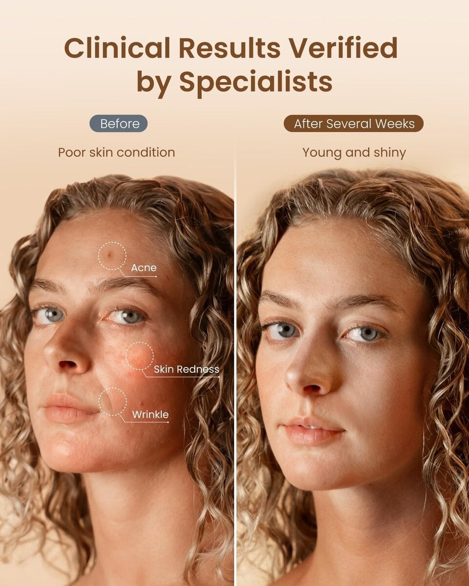 RENPHO LED Maske Gesicht mit 324 LED-Chips,Rotlicht Maske Gesicht mit 850nm NIR, 3 Modi Rote und Blaue,Die Tägliche Hautpflege 