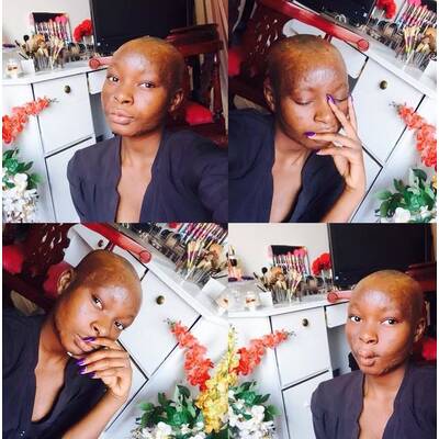 Brandopfer macht anderen Mut