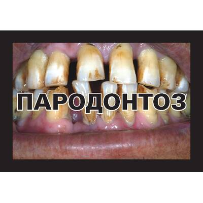 Russlands Zigarettenpackerl