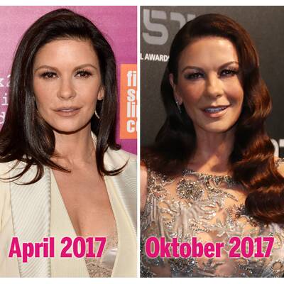 Catherine Zeta-Jones: Steckt sie in der Botoxfalle?